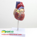 TopRanking 12479 Modelo anatômico do coração, tamanho da vida 2 peças anatomia modelo médico coração